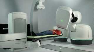 cyberknife